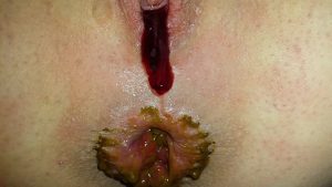 Anna_Coprofield - Quickly Shit In The Morning And The Beginning Of Menstruation 00002