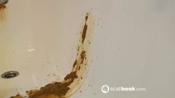 Explosive Di67657567567arrhea Scat 00002