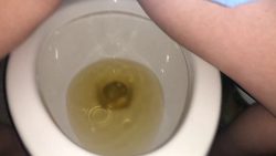 Every Piss I To567575676ok Today 00000