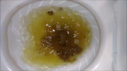 Rosebud Diarrhea And Farts 00002