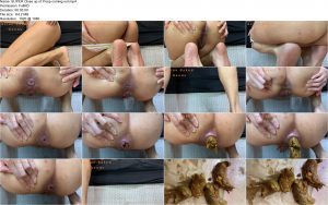 SUPER Close up of Poop coming out.ScrinList SUPER Close up of Poop coming out.ScrinList